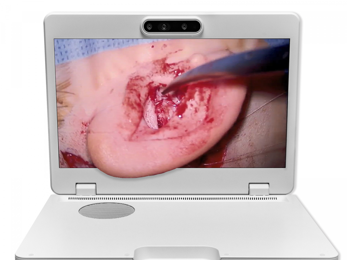 达擎之＂Heads-up 3D显微手术显示系统＂，整合4K裸眼3D显示及眼球追踪系统，具备快速追踪人眼移动位置功能，减轻医师长时间维持固定姿势的负担，让医师能有更宽广清晰的3D立体视野及更舒适的姿势来执行手术。